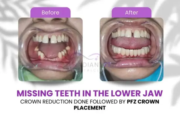 Crowns and bridges treatment room at Radiant 32, Bhowanipore