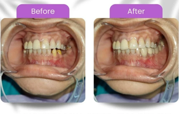 Dentures and partials treatment room at Radiant 32, Bhowanipore